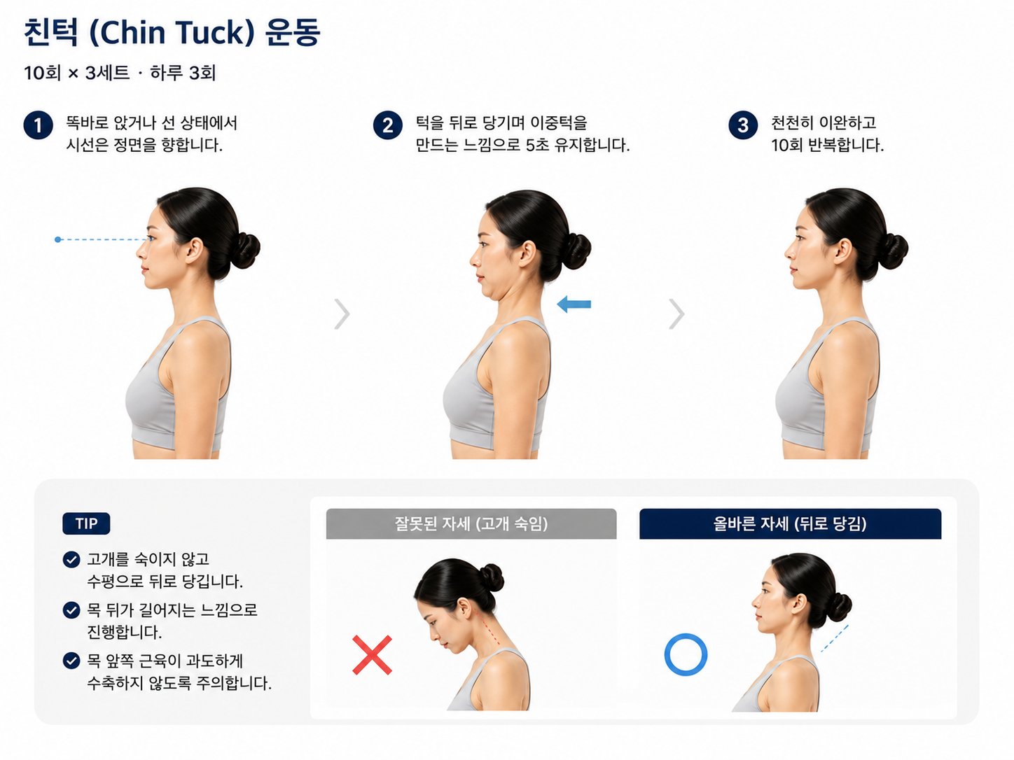 친턱 운동
