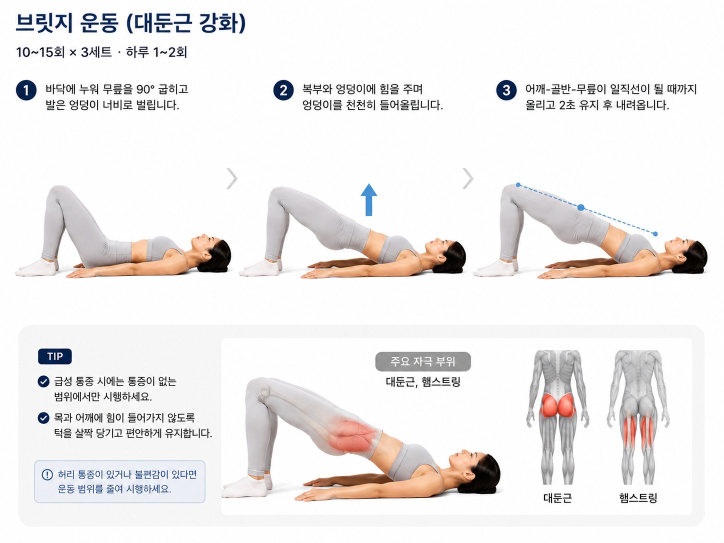 브릿지 운동