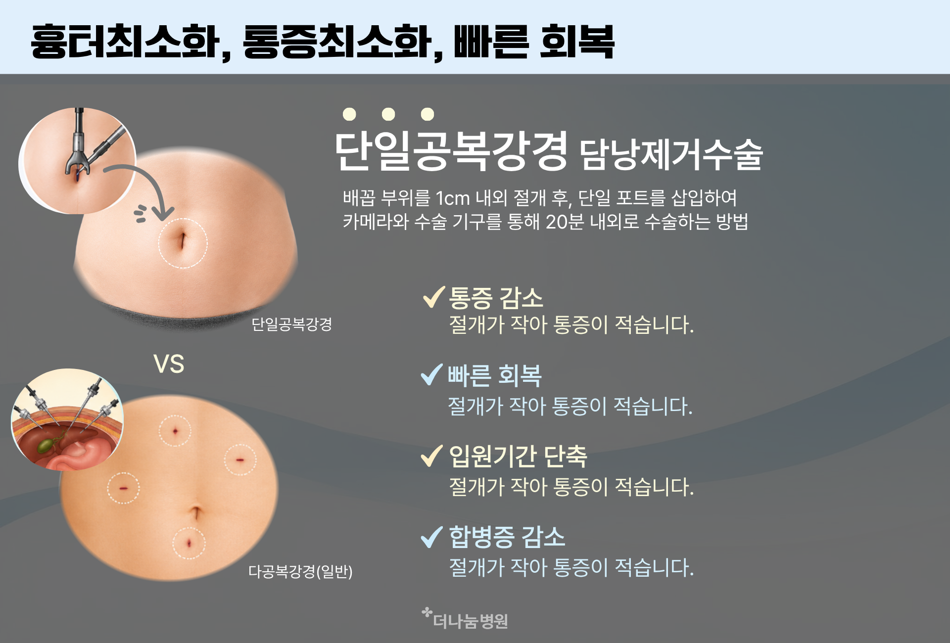 단일공복강경 담낭제거술은 흉터최소화 통증최소화 빠른회복을 돕습니다. 