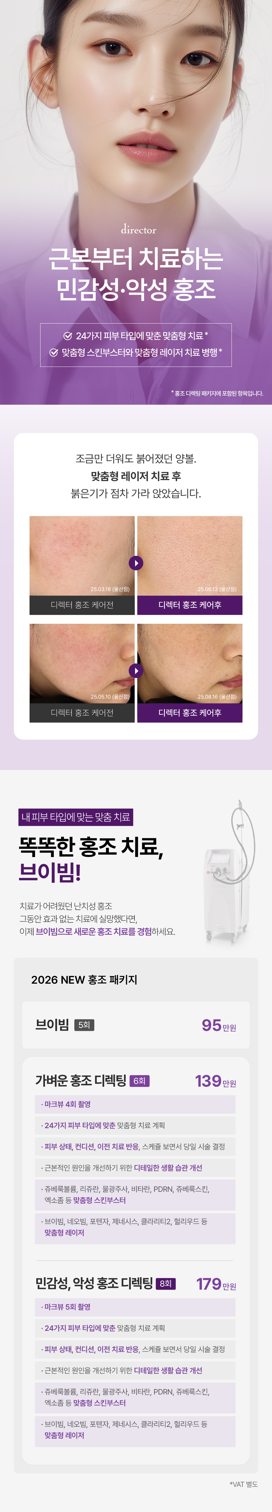 똑똑한 홍조 치료, 브이빔, 맞춤형 스킨부스터와 레이저