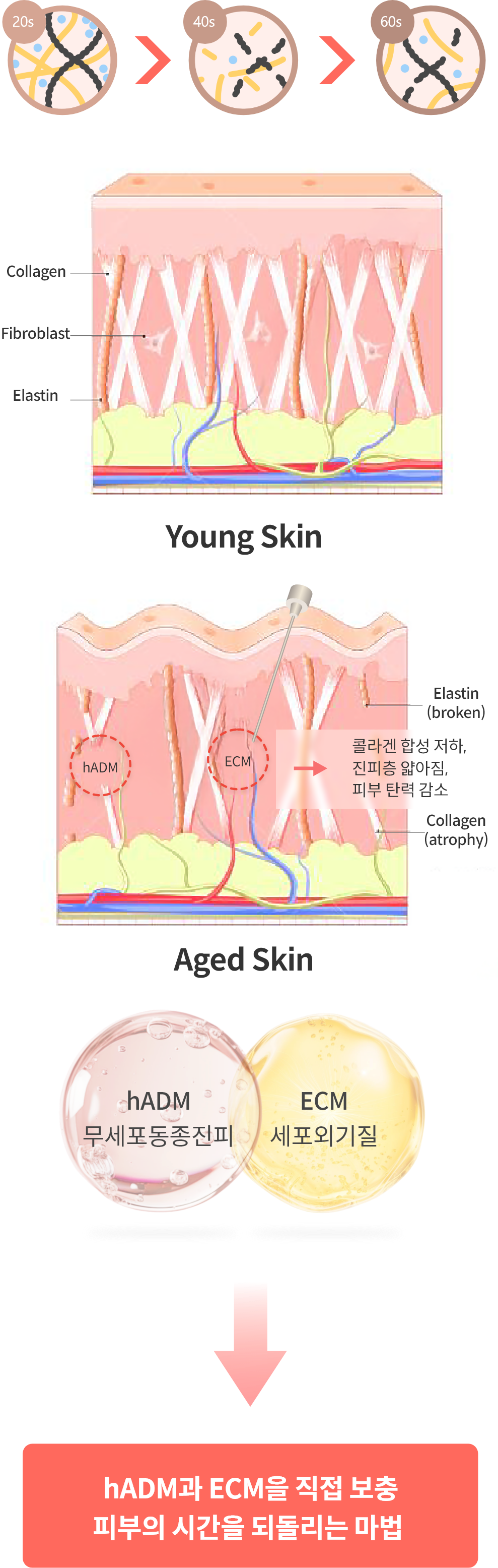 분당 야탑 피부과 엘라비에 리투오, 피부 노화가 진행되면 주름, 모공 확장, 피부처짐 발생합니다