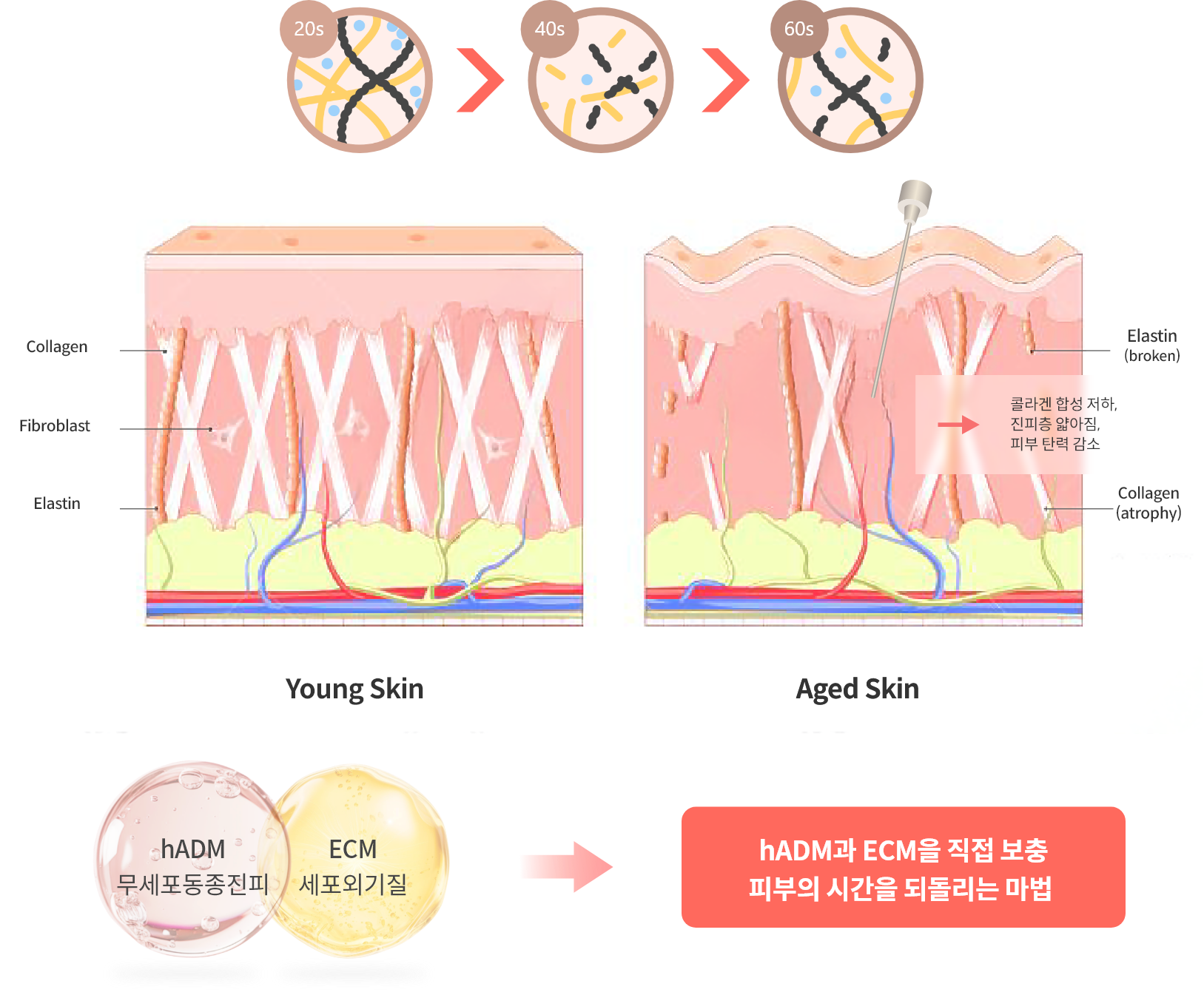 야탑피부과 분당리투오, 엘라비에 리투오 피부노화가 진행되면 주름, 모공 확장, 피부 처짐이 발생한다