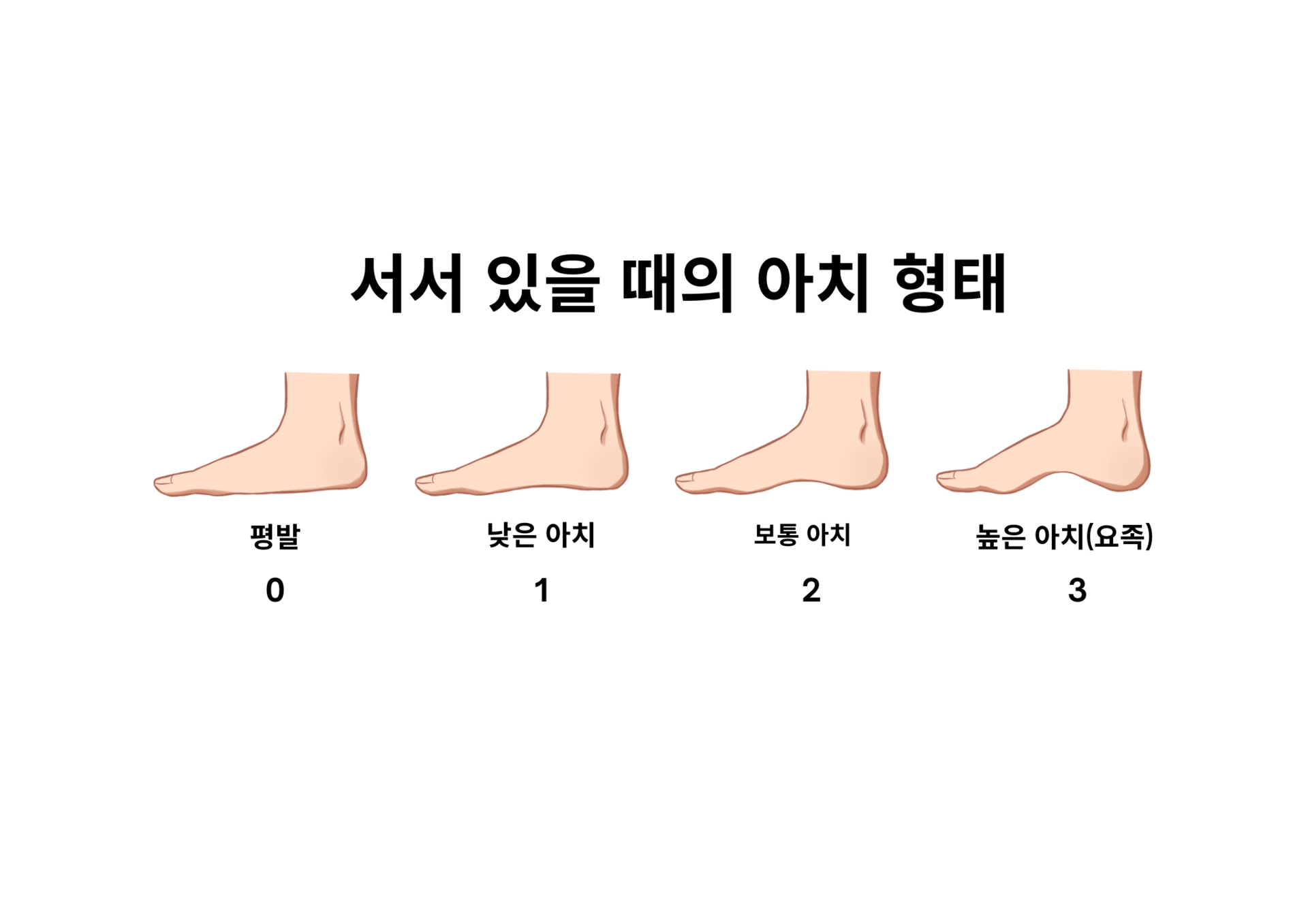 아치 형태 설명