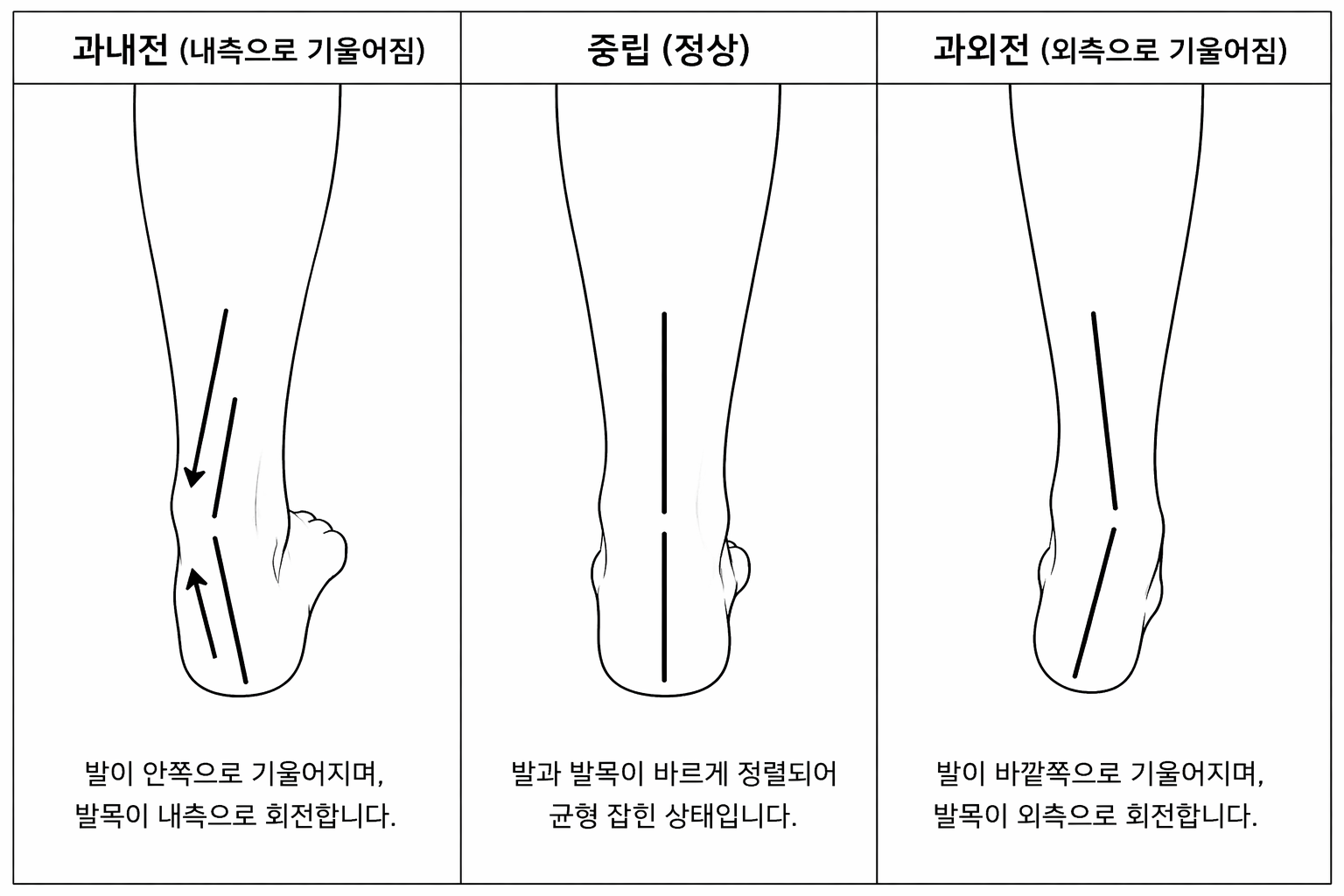 발목 형태