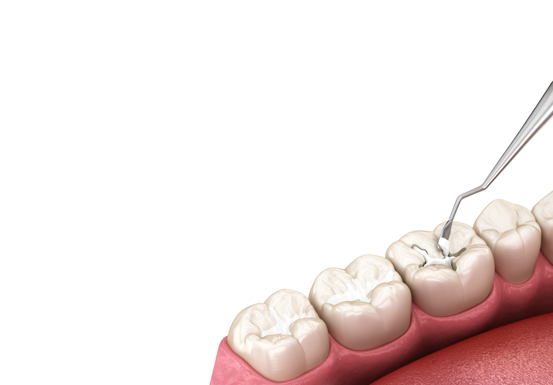 <div class="implant-m-card-v4">   <div class="implant-m-head-v4">     <div class="implant-m-title-v4">일반진료</div>     <p class="implant-m-desc-v4">잇몸 · 충치 · 사랑니 · 턱관절</p>   </div>    <div class="implant-m-copy-v4">     <span class="implant-m-copy-big-v4">일상의 작은 불편함부터,</span>     <span class="implant-m-copy-small-v4">돌봅니다</span>   </div>    <span class="implant-m-more-v4">     <span class="implant-m-more-text-v4">자세히 보기</span>   </span> </div>  <style> .implant-m-card-v4 {   display: block !important;   width: 100% !important;   padding: 19px 16px 24px 10px !important;   margin: 0 !important;   font-family: 'Pretendard', 'Noto Sans KR', sans-serif !important;   box-sizing: border-box !important;   position: relative !important;   z-index: 10 !important; }  .implant-m-head-v4 {   transform: translateY(-4px) !important; }  .implant-m-title-v4 {   display: block !important;   margin: 0 0 8px 0 !important;   padding: 0 !important;   font-size: 24px !important;   font-weight: 700 !important;   line-height: 1.08 !important;   letter-spacing: -0.5px !important;   color: #222222 !important; }  .implant-m-desc-v4 {   display: block !important;   margin: 0 0 16px 0 !important;   padding: 0 !important;   font-size: 14px !important;   font-weight: 500 !important;   line-height: 1.3 !important;   color: #999999 !important; }  .implant-m-copy-v4 {   display: block !important;   margin: 0 0 20px 0 !important;   padding: 0 !important;   transform: translateY(-7px) !important;   line-height: 1.25 !important;   letter-spacing: -0.3px !important;   color: #444444 !important; }  .implant-m-copy-big-v4, .implant-m-copy-small-v4 {   display: block !important;   margin: 0 !important;   padding: 0 !important;   font-size: 15px !important;   font-weight: 600 !important;   line-height: 1.25 !important;   color: #444444 !important; }  .implant-m-copy-big-v4 {   margin-bottom: 3px !important; }  .implant-m-more-v4 {   display: inline-flex !important;   align-items: center !important;   justify-content: flex-start !important;   transform: translateY(4px) !important;   padding: 0 0 5px 0 !important;   margin: 0 !important;   border-bottom: 1px solid #619b34 !important;   color: #619b34 !important;   line-height: 1 !important;   background: none !important;   text-decoration: none !important;   box-shadow: none !important;   outline: none !important;   cursor: default !important;   pointer-events: none !important; }  .implant-m-more-text-v4 {   display: block !important;   margin: 0 !important;   padding: 0 !important;   border: 0 !important;   font-size: 14px !important;   font-weight: 600 !important;   line-height: 1 !important;   letter-spacing: -0.2px !important;   color: #619b34 !important; } </style>