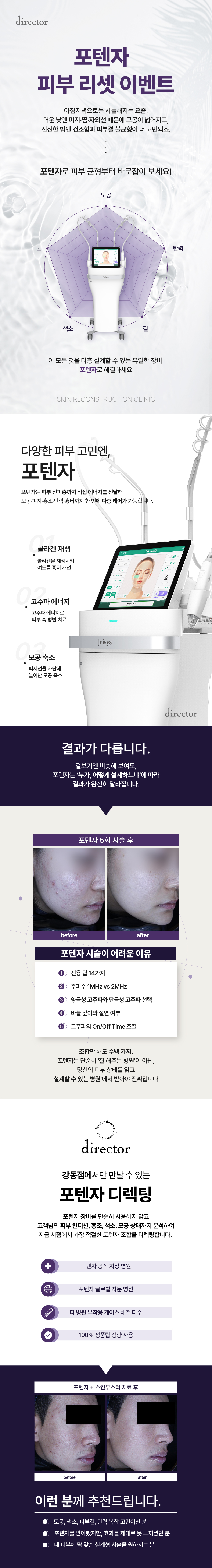 포텐자 리프팅 – 나비존 모공·피부결 개선과 톤업 효과를 함께 기대할 수 있는 스킨부스터 레이저 시술