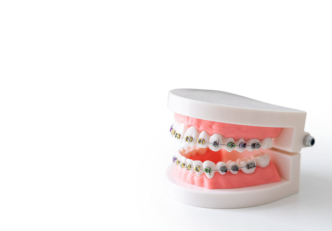 <div class="implant-m-card-v4">   <div class="implant-m-head-v4">     <div class="implant-m-title-v4">치아교정</div>     <p class="implant-m-desc-v4">클리피씨</p>   </div>    <div class="implant-m-copy-v4">     <span class="implant-m-copy-big-v4">자신 있게</span>     <span class="implant-m-copy-small-v4">웃을 수 있도록</span>   </div>    <span class="implant-m-more-v4">     <span class="implant-m-more-text-v4">자세히 보기</span>   </span> </div>  <style> .implant-m-card-v4 {   display: block !important;   width: 100% !important;   padding: 19px 16px 24px 10px !important;   margin: 0 !important;   font-family: 'Pretendard', 'Noto Sans KR', sans-serif !important;   box-sizing: border-box !important;   position: relative !important;   z-index: 10 !important; }  .implant-m-head-v4 {   transform: translateY(-4px) !important; }  .implant-m-title-v4 {   display: block !important;   margin: 0 0 8px 0 !important;   padding: 0 !important;   font-size: 24px !important;   font-weight: 700 !important;   line-height: 1.08 !important;   letter-spacing: -0.5px !important;   color: #222222 !important; }  .implant-m-desc-v4 {   display: block !important;   margin: 0 0 16px 0 !important;   padding: 0 !important;   font-size: 14px !important;   font-weight: 500 !important;   line-height: 1.3 !important;   color: #999999 !important; }  .implant-m-copy-v4 {   display: block !important;   margin: 0 0 20px 0 !important;   padding: 0 !important;   transform: translateY(-7px) !important;   line-height: 1.25 !important;   letter-spacing: -0.3px !important;   color: #444444 !important; }  .implant-m-copy-big-v4, .implant-m-copy-small-v4 {   display: block !important;   margin: 0 !important;   padding: 0 !important;   font-size: 15px !important;   font-weight: 600 !important;   line-height: 1.25 !important;   color: #444444 !important; }  .implant-m-copy-big-v4 {   margin-bottom: 3px !important; }  .implant-m-more-v4 {   display: inline-flex !important;   align-items: center !important;   justify-content: flex-start !important;   transform: translateY(4px) !important;   padding: 0 0 5px 0 !important;   margin: 0 !important;   border-bottom: 1px solid #619b34 !important;   color: #619b34 !important;   line-height: 1 !important;   background: none !important;   text-decoration: none !important;   box-shadow: none !important;   outline: none !important;   cursor: default !important;   pointer-events: none !important; }  .implant-m-more-text-v4 {   display: block !important;   margin: 0 !important;   padding: 0 !important;   border: 0 !important;   font-size: 14px !important;   font-weight: 600 !important;   line-height: 1 !important;   letter-spacing: -0.2px !important;   color: #619b34 !important; } </style>