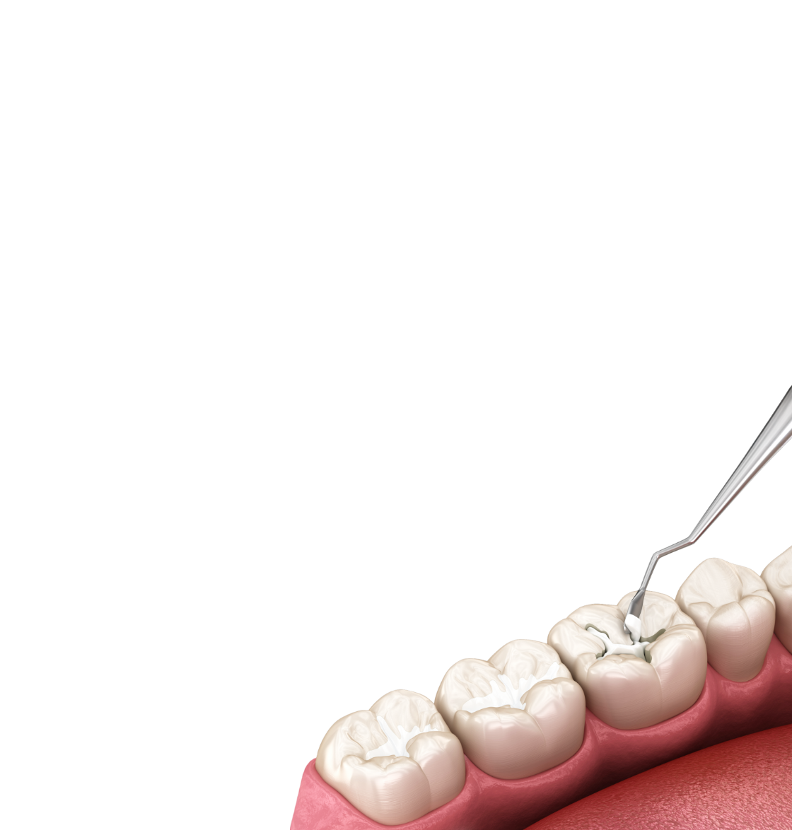 <div class="implant-pc-card-v4">   <div class="implant-pc-head-v4">     <div class="implant-pc-title-v4">일반진료</div>     <p class="implant-pc-desc-v4">잇몸 · 충치 · 사랑니 · 턱관절</p>   </div>    <div class="implant-pc-copy-v4">     <span class="implant-pc-copy-big-v4">일상의 작은 불편함부터,</span>     <span class="implant-pc-copy-small-v4">돌봅니다</span>   </div>    <span class="implant-pc-btn-v4">     <span class="implant-pc-btn-text-v4">자세히 보기</span>   </span> </div>  <style> .implant-pc-card-v4 {   padding: 60px 40px !important;   font-family: 'Pretendard', 'Noto Sans KR', sans-serif !important;   box-sizing: border-box !important; }  /* 상단 영역 */ .implant-pc-head-v4 {   transform: translateY(-10px) !important; }  .implant-pc-title-v4 {   margin: 0 0 12px !important;   font-size: 36px !important;   font-weight: 700 !important;   line-height: 1.1 !important;   letter-spacing: -0.5px !important;   color: #222222 !important; }  .implant-pc-desc-v4 {   margin: 0 0 32px !important;   font-size: 16px !important;   font-weight: 500 !important;   color: #999999 !important; }  /* 중간 카피 */ .implant-pc-copy-v4 {   margin: 0 0 42px !important;   transform: translateY(-12px) !important;   line-height: 1.25 !important;   letter-spacing: -0.3px !important;   color: #444444 !important; }  .implant-pc-copy-big-v4, .implant-pc-copy-small-v4 {   display: block !important;   margin: 0 !important;   font-size: 18px !important;   font-weight: 600 !important;   line-height: 1.25 !important;   color: #444444 !important; }  .implant-pc-copy-big-v4 {   margin-bottom: 4px !important; }  /* 자세히 보기 */ .implant-pc-btn-v4 {   display: inline-flex !important;   align-items: center !important;   justify-content: flex-start !important;   position: relative !important;   transform: translateY(16px) !important;   padding: 0 0 7px 0 !important;   border-bottom: 1px solid #619b34 !important;   color: #619b34 !important;   line-height: 1 !important;   text-decoration: none !important;   background: none !important;   box-shadow: none !important;   outline: none !important;   cursor: default !important;   pointer-events: none !important; }  .implant-pc-btn-text-v4 {   display: block !important;   margin: 0 !important;   padding: 0 !important;   border: 0 !important;   font-size: 17px !important;   font-weight: 600 !important;   line-height: 1 !important;   letter-spacing: -0.2px !important;   color: #619b34 !important; } </style>