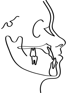<p style="line-height: 2;"><span style="font-size: 16px;">치아 맹출 방향</span></p>