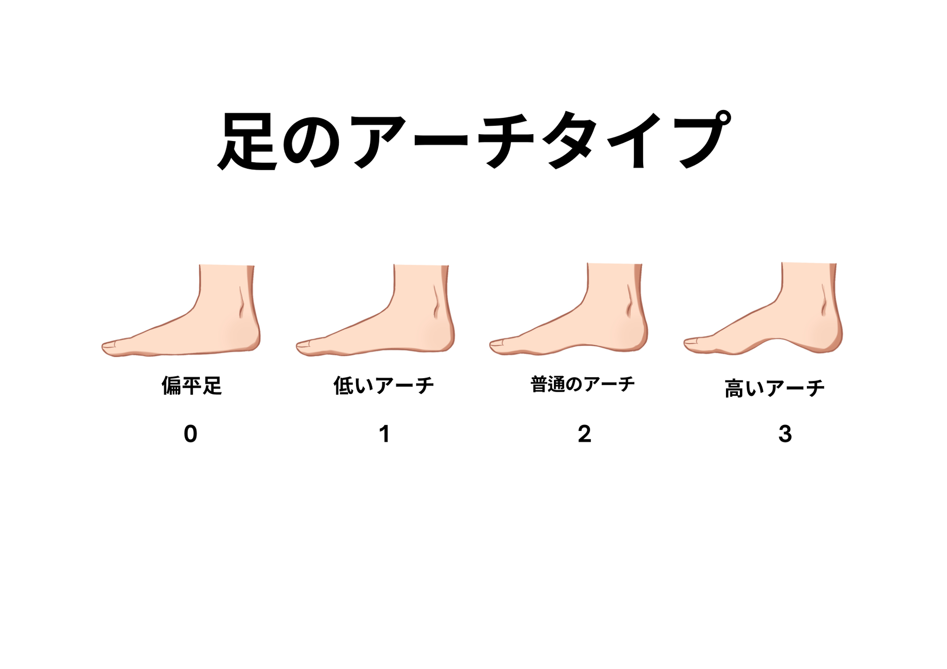 アーチタイプ説明