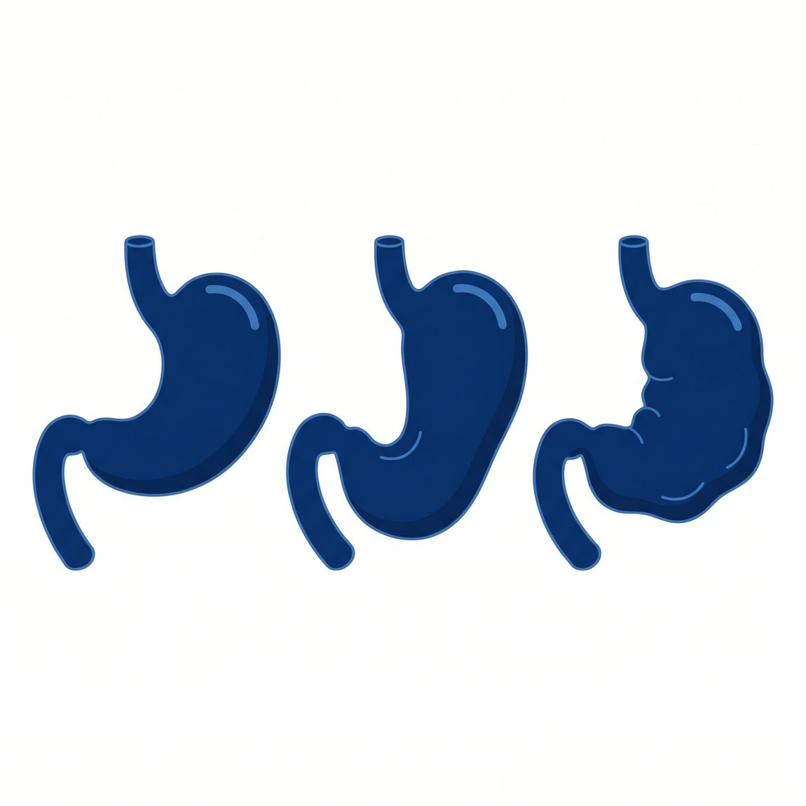 정상 위 위하수 위무력 비교