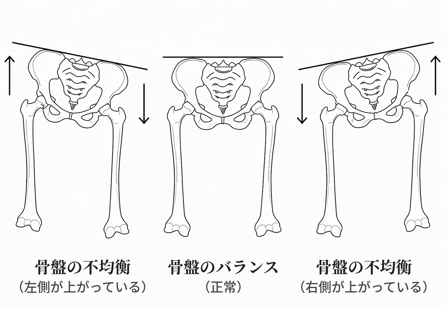 骨盤バランス