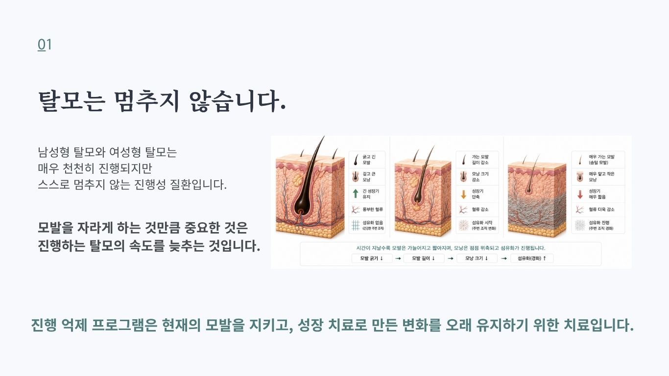탈모 진행 속도를 늦추고 현재 모발을 유지하기 위한 진행 억제 프로그램