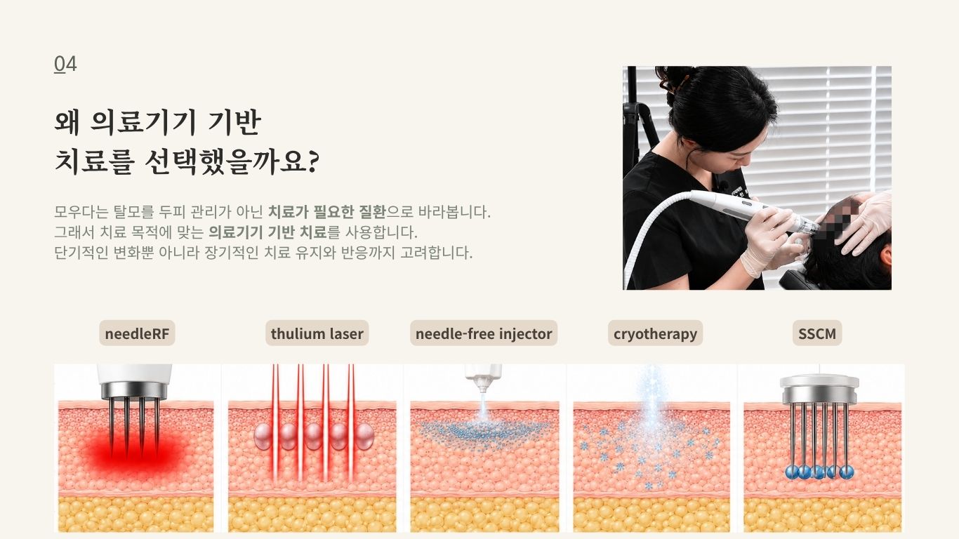 의료기기 기반 탈모 치료 장비와 약물 전달 원리