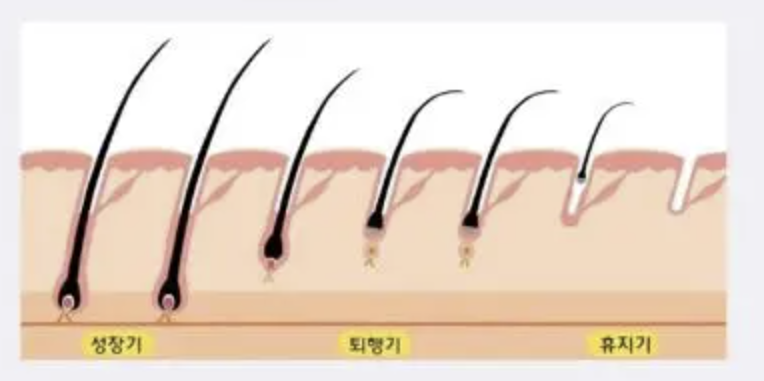 천호동클라리티 레이저제모 모낭 성장 주기 단계별 설명 일러스트