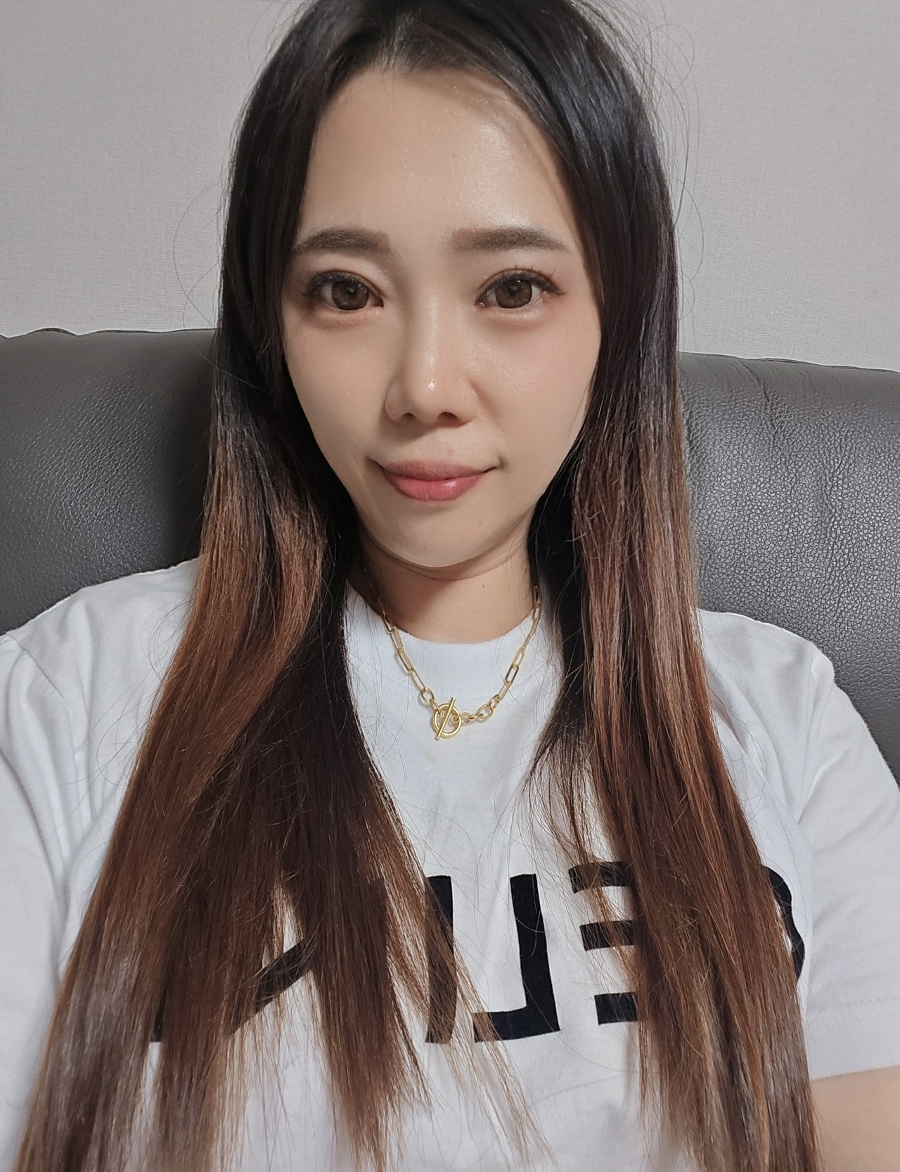절개쌍꺼풀재수술 1개월 후