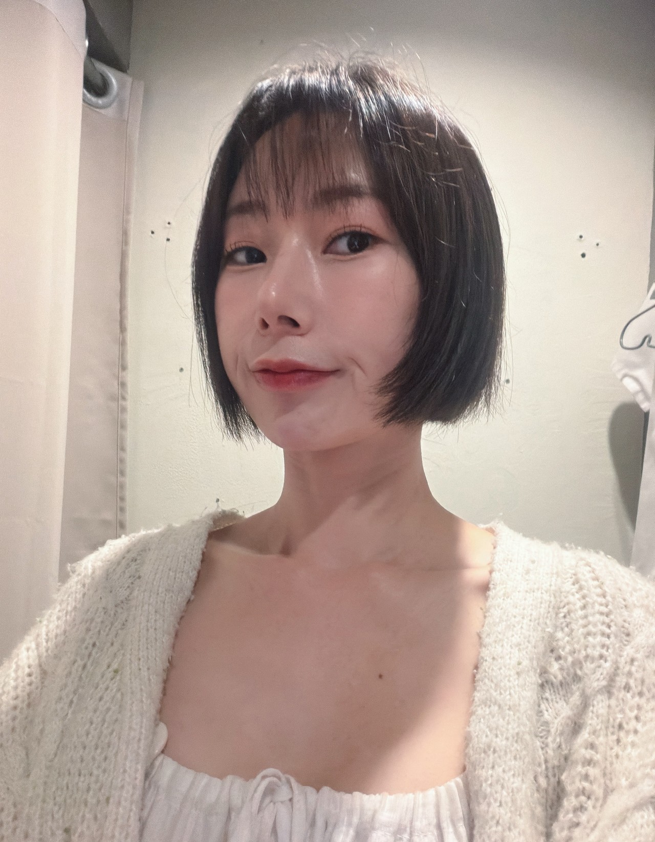 눈밑지방재배치 1개월 후