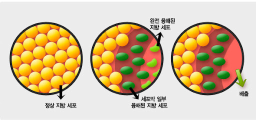 서울윤곽주사 지방세포 분해 배출 단계별 과정 일러스트