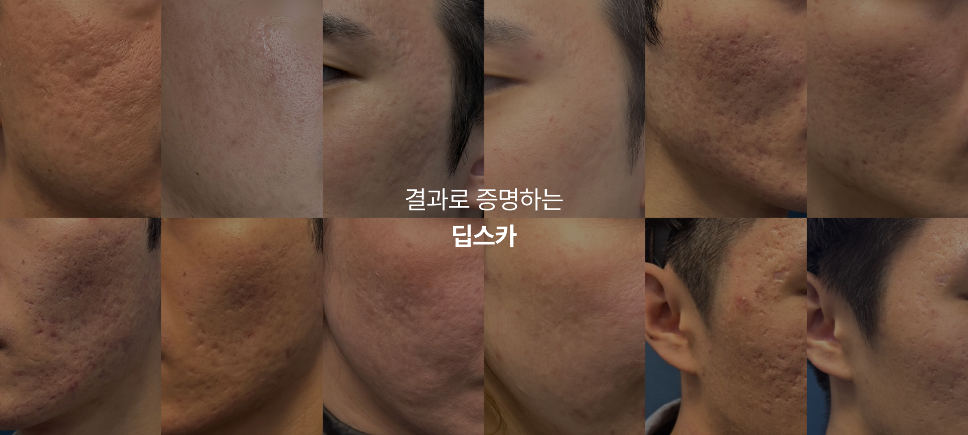 결과로 증명하는 딥스카