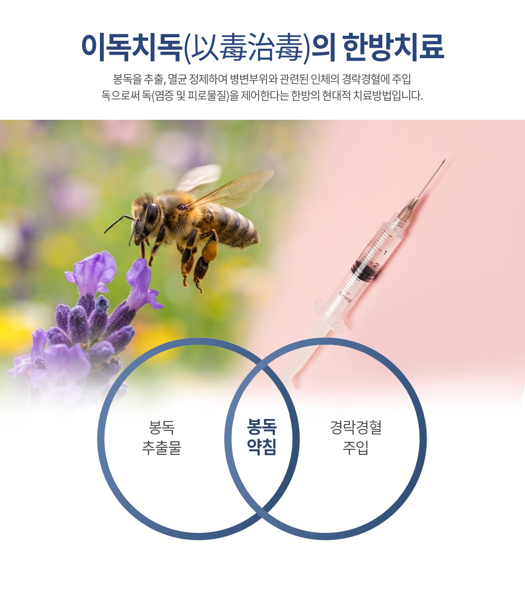 대한민국365한의원_봉독약침 치료