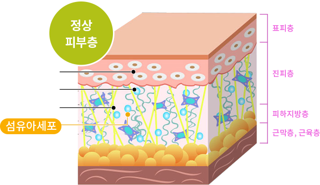 울산포텐자 진피층 섬유아세포 콜라겐 구조 설명 인포그래픽