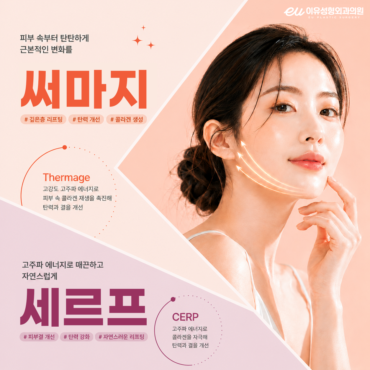 이유 써마지/세르프 이벤트