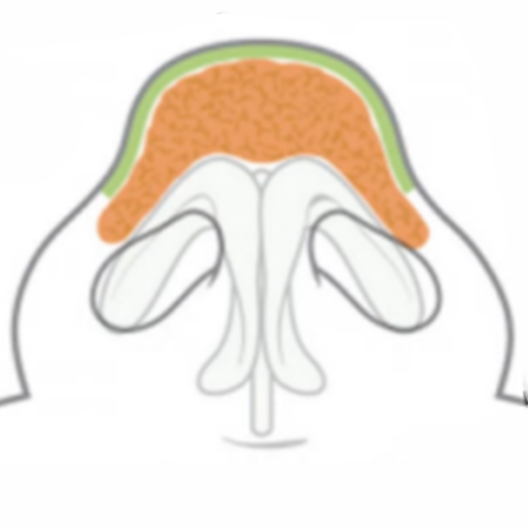 <span style="color: #FFFFFF">두꺼운 피부</span>