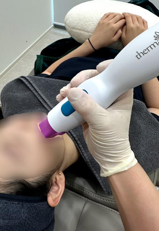 강동 고주파리프팅 시술 중 고주파 장비로 얼굴 부위별 에너지를 조사하고 있습니다