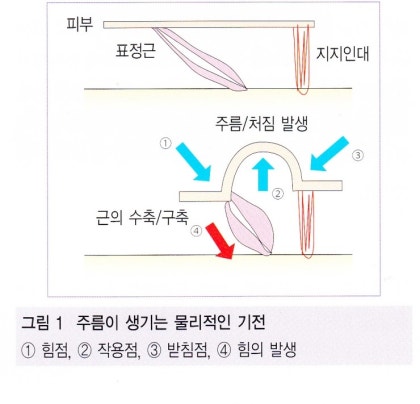 강동눈가잔주름이 발생하는 원리와 표정근 수축에 따른 피부 주름 형성을 설명하는 이미지