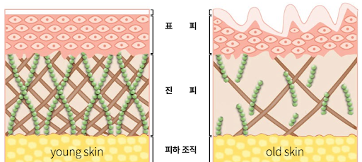 강동눈가잔주름이 생기는 원인과 젊은 피부, 노화된 피부의 콜라겐 및 탄력섬유 변화를 비교한 이미지