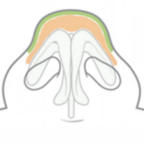 <span style="color: #FFFFFF">비익연골 발달</span>