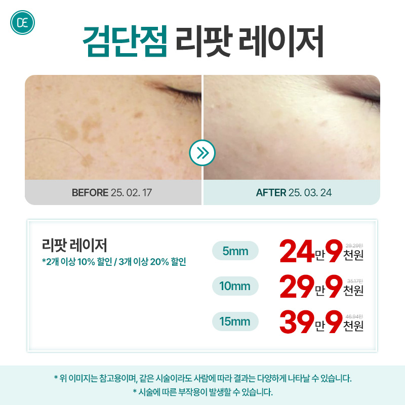 리팟