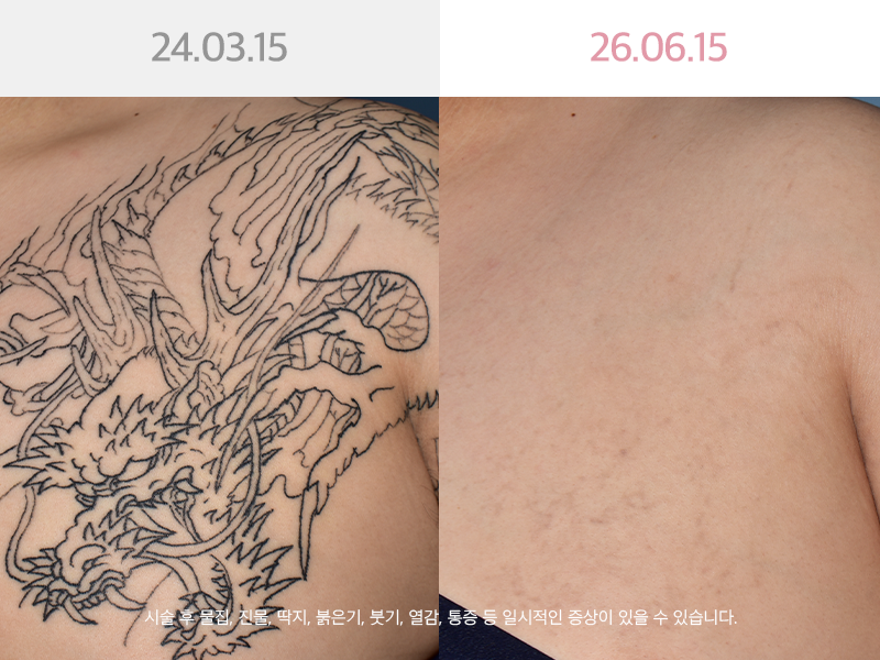 사진을  클릭해주세요↑