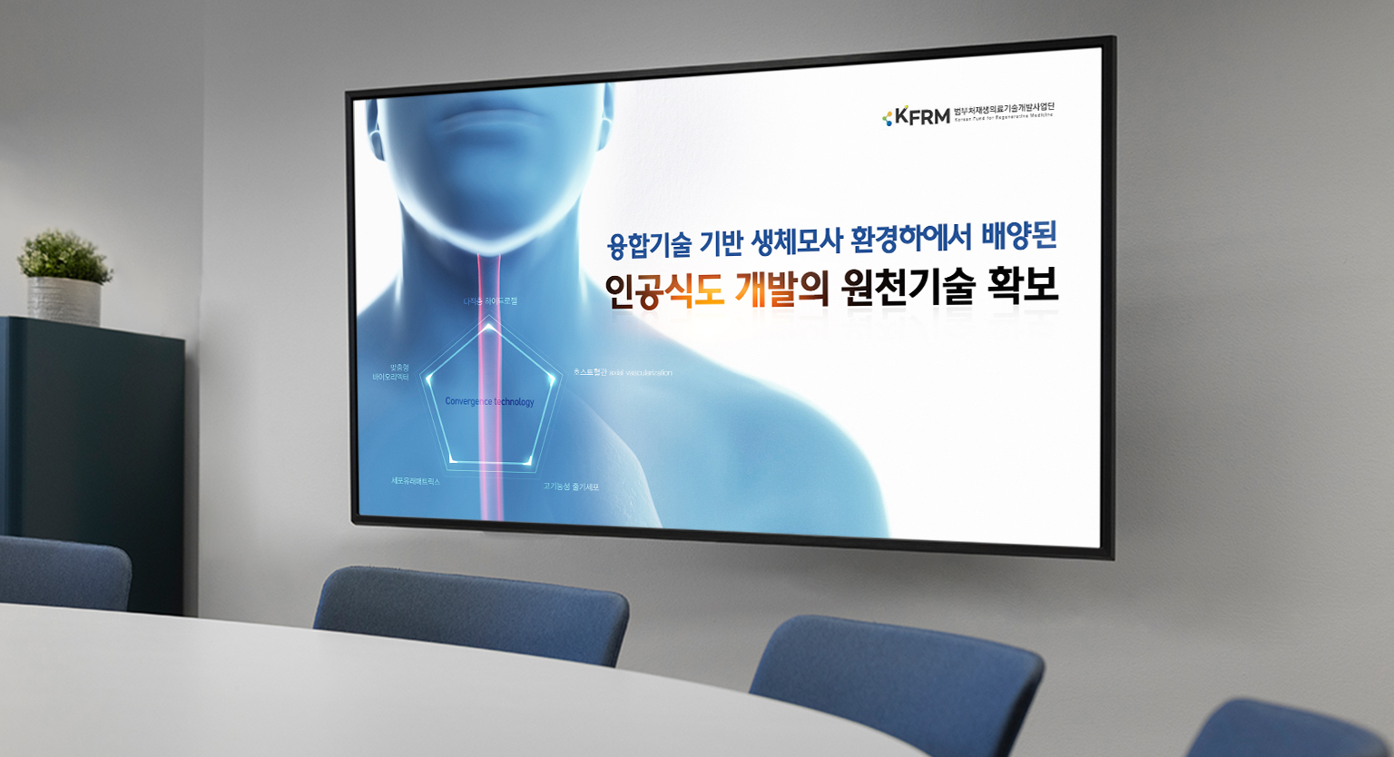 서울대학교병원 이비인후과 정부 연구과제 제안 ppt표지 회의실 목업 적용