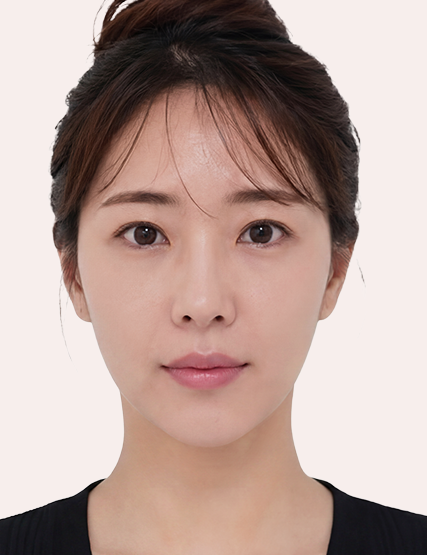 관리 후 이미지