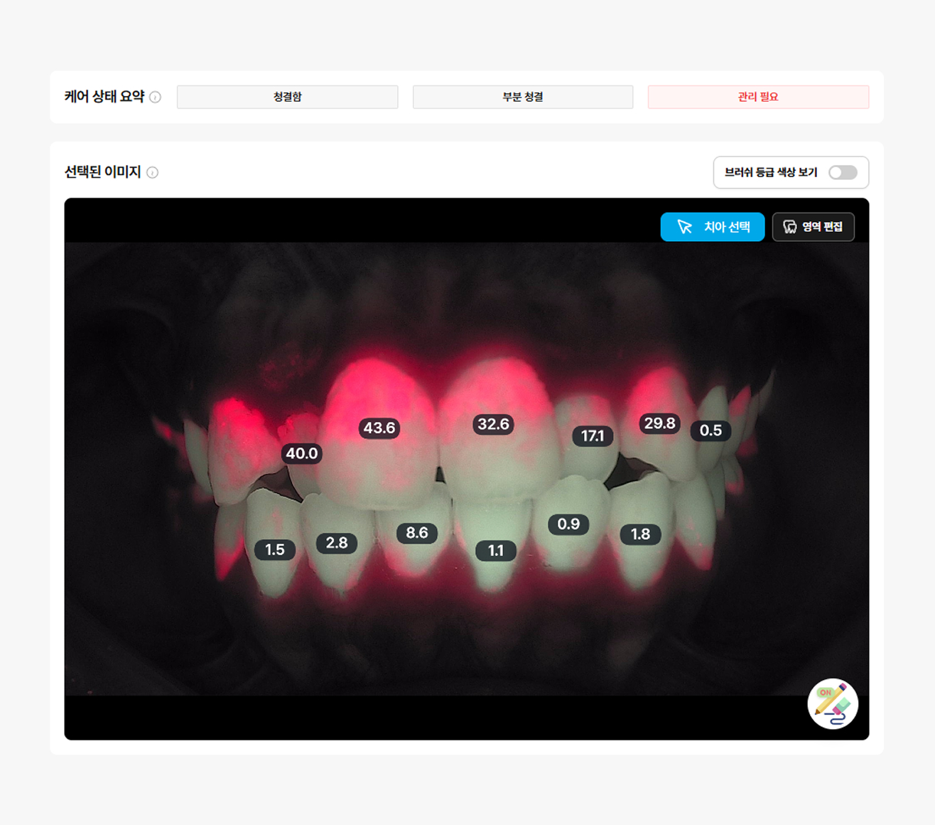 큐레이 분석