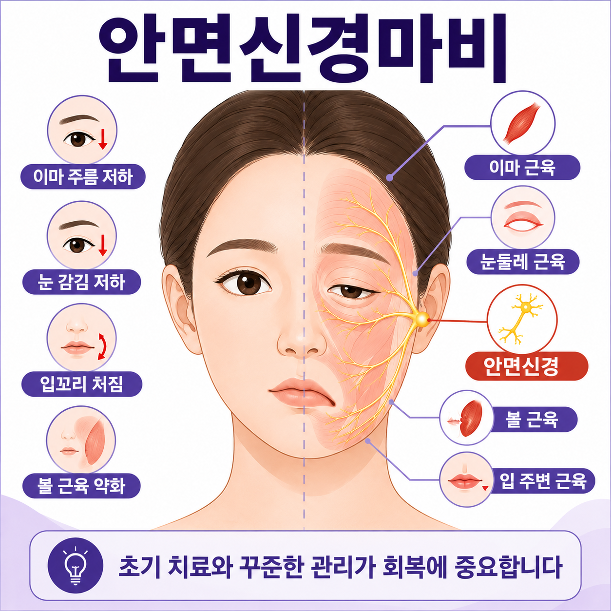 안면마비 안면신경마비