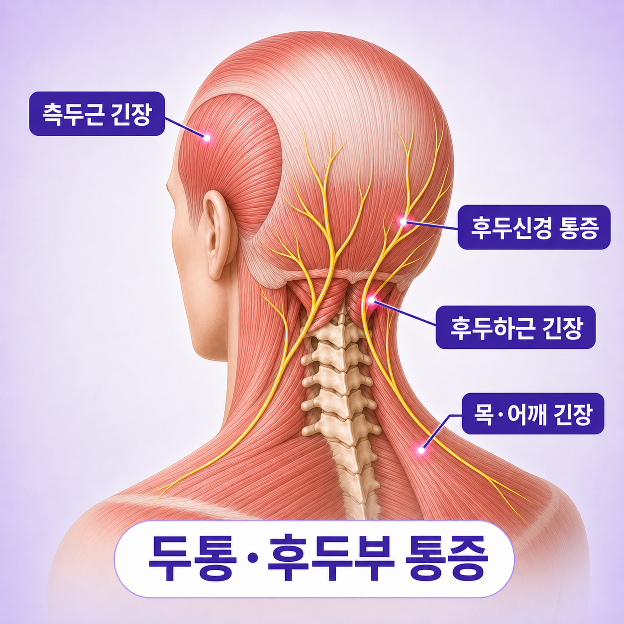 교통사고 후 목 어깨 통증과 후두부 통증