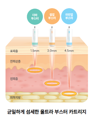 울산슈링크유니버스 울트라 부스터 카트리지 더마·셀업·라인업 부스터 시술 깊이 비교 이미지