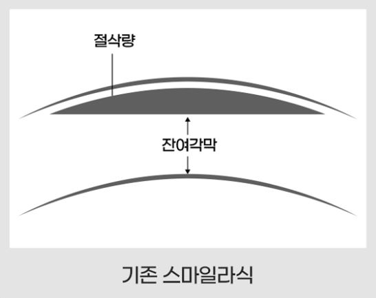 렌티큘 엣지 1