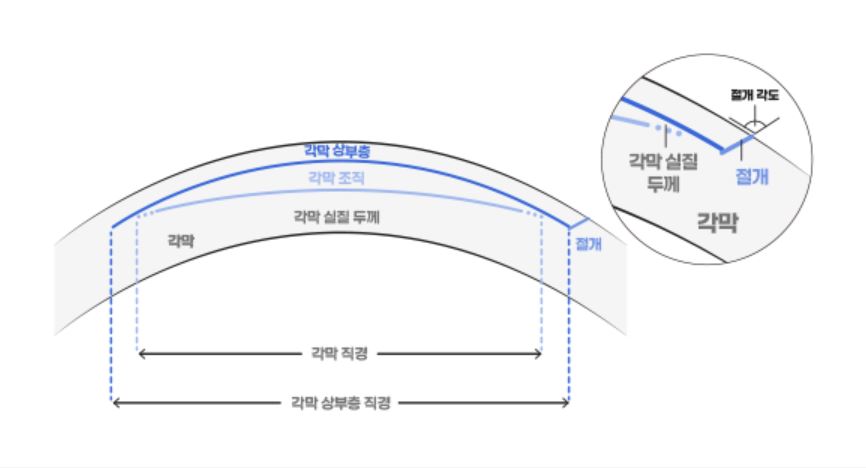 최소 접수 설계 & 데이터 연동