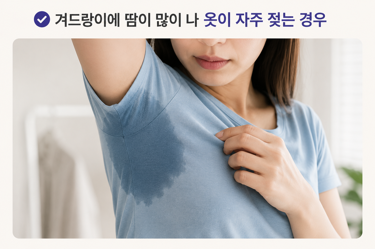 다한증보톡스 추천대상