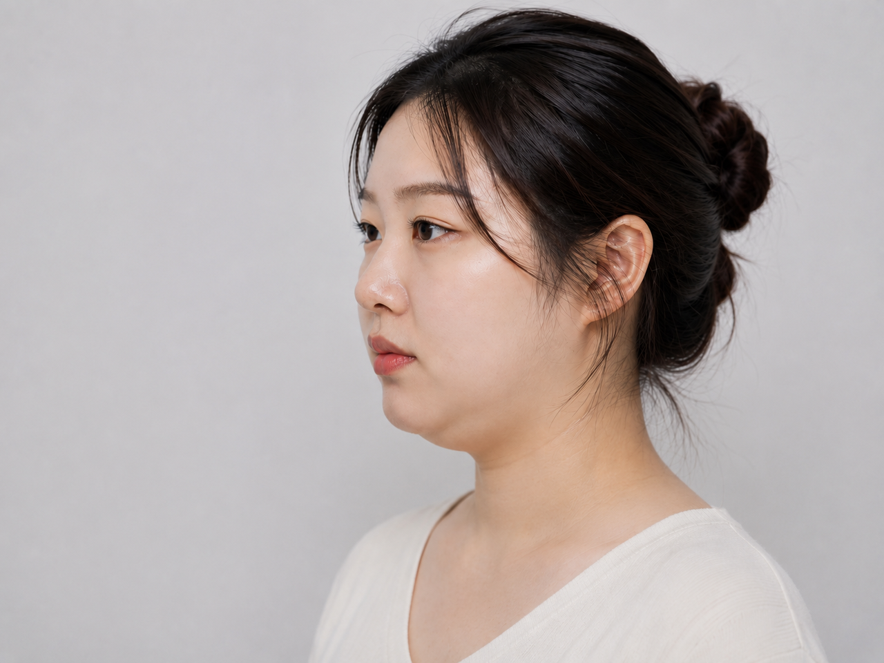 이중턱 개선