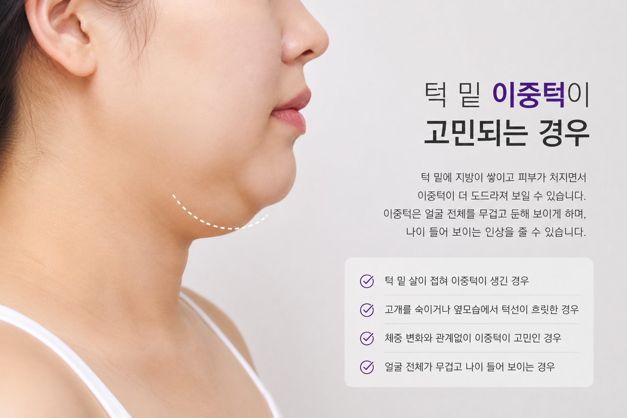 인모드 추천대상