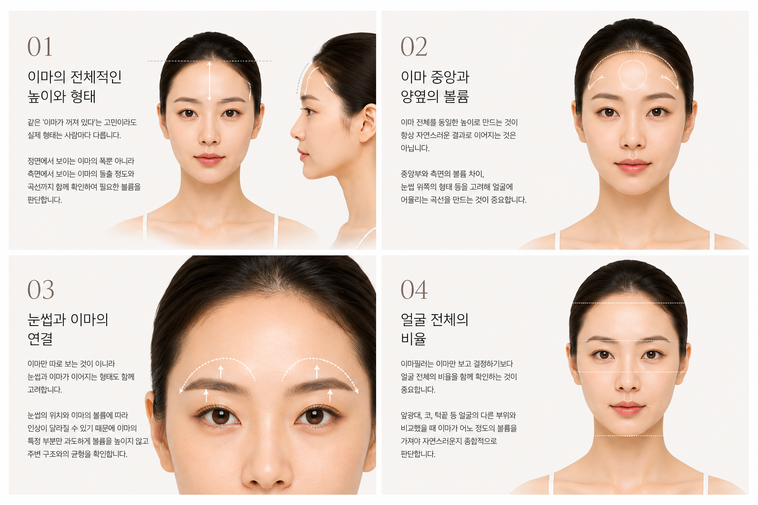 이마필러 고려사항