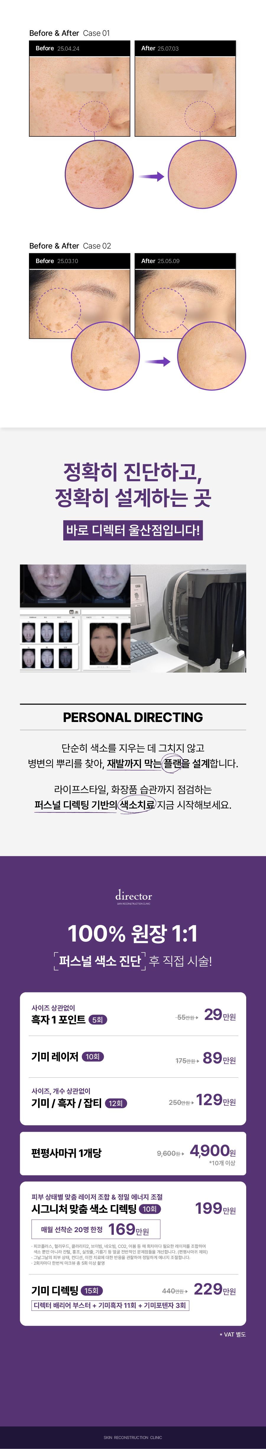 울산 피부과 레이저 복합치료로 기미 잡티 점 제거 