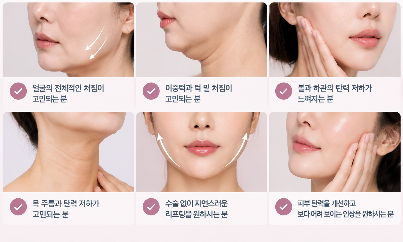 울쎄라 추천대상