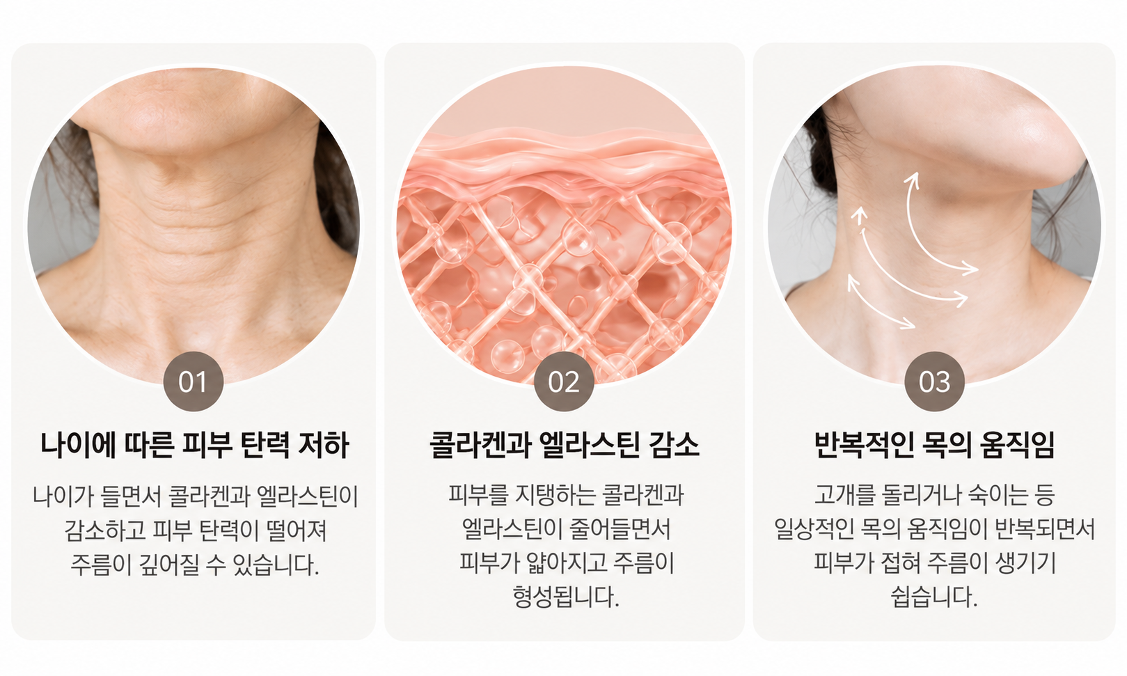 목주름의 원인