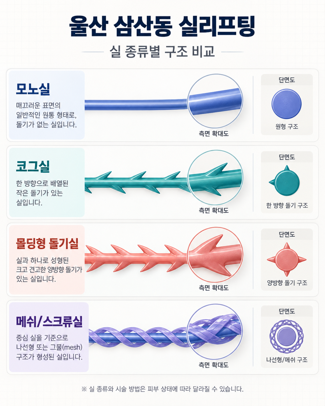 울산삼산동실리프팅 실 종류별 구조 비교 인포그래픽