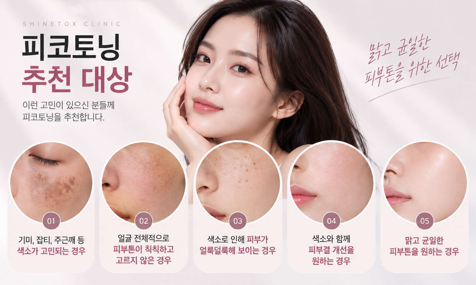 피코토닝 추천대상